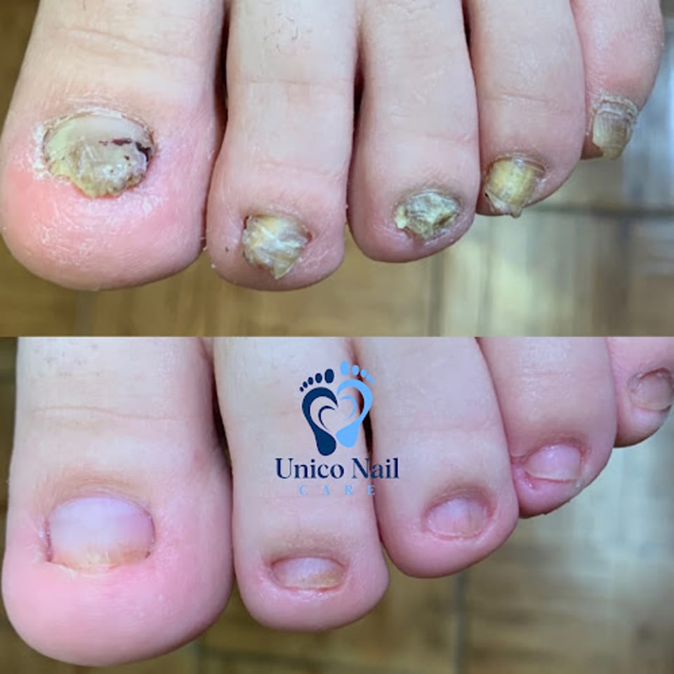 Unico Nail Care photo 1